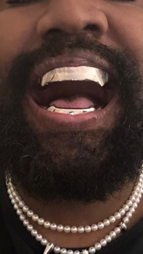 close-up of kanye west's teeth with titanium dentures